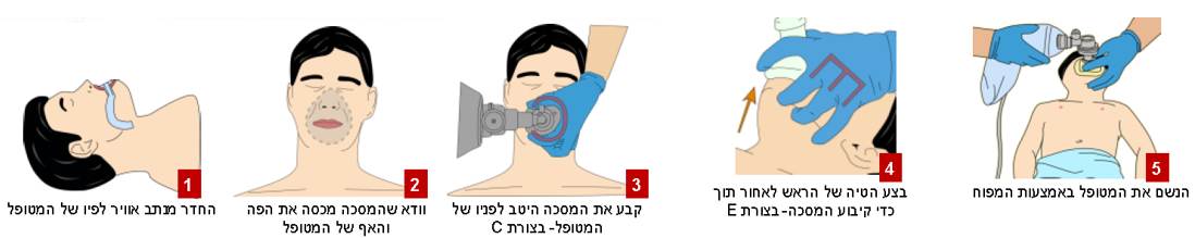 טכניקת CE